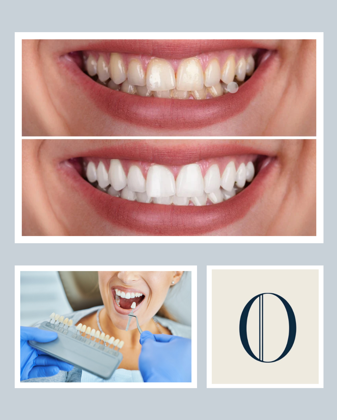 Patient with a bright, whitened smile