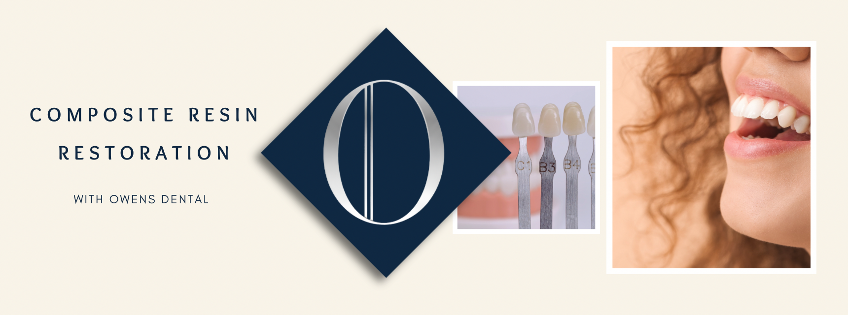 Composite Resin Restoration at Owens Dental